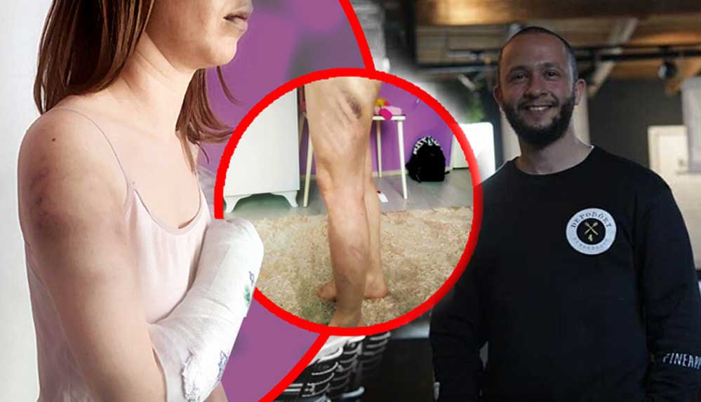 İzmir'de kadına şiddet: 'Fotoğraf beğendiği' için kız arkadaşının beyzbol sopasıyla saldırdı, kolunu kırdı