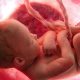 Plasenta previa anne ve bebeğin hayatını riske atabiliyor