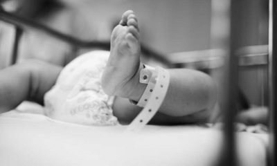 Brezilya’da bir bebek 12 santimetre kuyrukla doğdu
