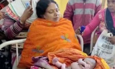 Hindistan'da dört kollu ve dört bacaklı bebek dünyaya geldi