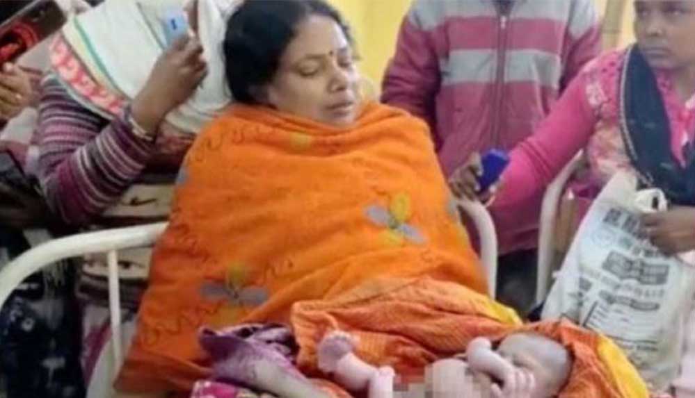 Hindistan'da dört kollu ve dört bacaklı bebek dünyaya geldi