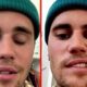Yüz felci geçiren Justin Bieber, sağlık durumu hakkında konuştu