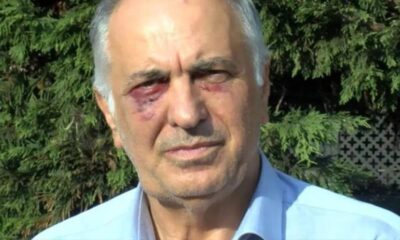 Saldırıya uğrayan Kartal Cemevi Başkanı Selami Sarıtaş: Naki D. ile husumetli değilim